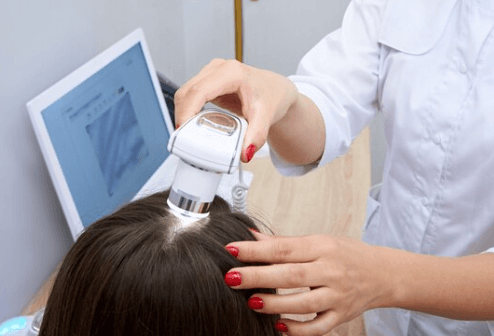 Scalp Micro-Pigmentation